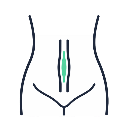 Diastasis Recti (Muscle Gap) Closing abdominal gaps after pregnancyweight loss.