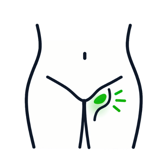 Femoral Hernia (Groin) Emergency groin repair prevents bowel blockage.