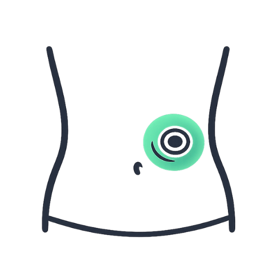 Parastomal Hernia (Stoma) Strengthening abdominal walls around surgical stomas.