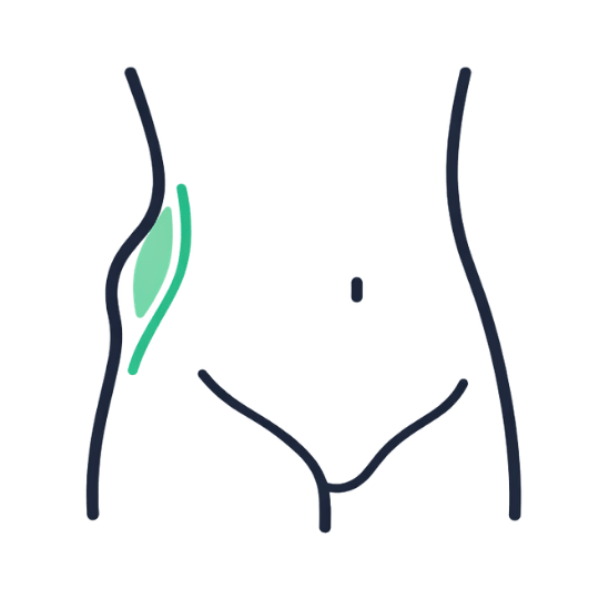 Spigelian Hernia (Side) Expert repair of deep side-wall defects.