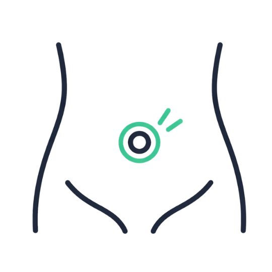 Umbilical Hernia (Navel) Belly button protrusion same-day discharge surgery.