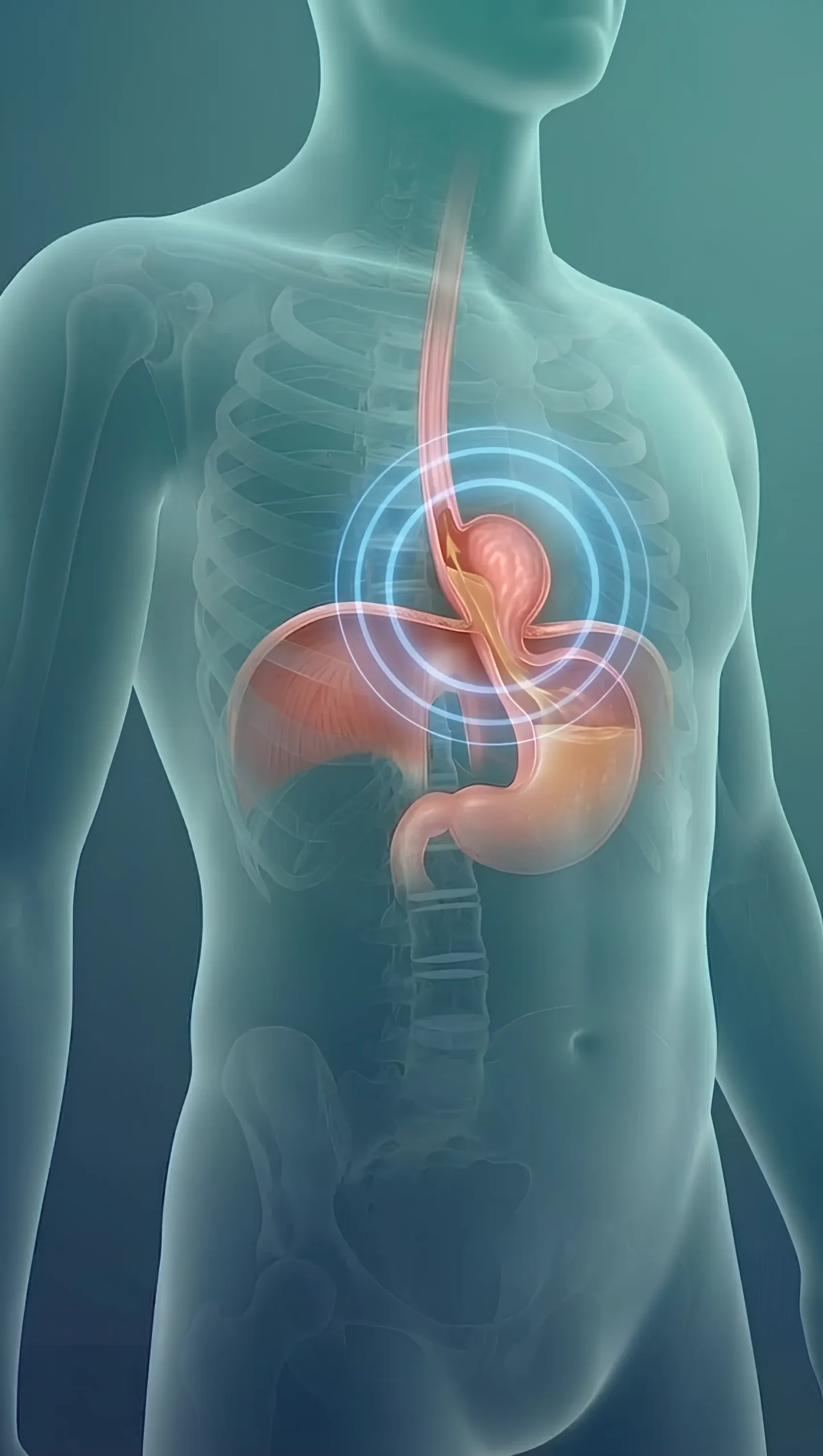 What is Hiatal Hernia - By Dr Harsh Shah