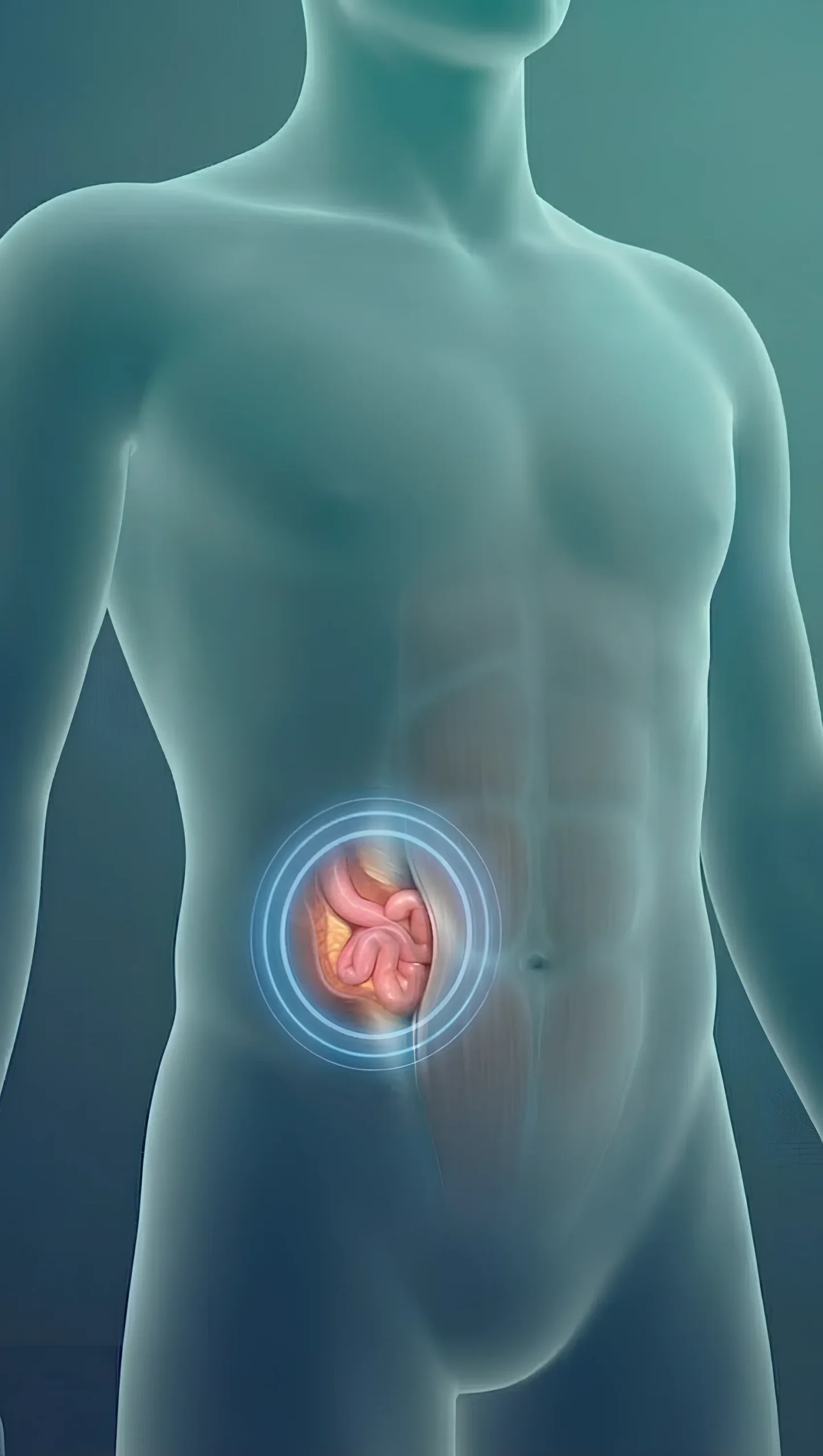 What is Spigelian Hernia - Dr Harsh Shah